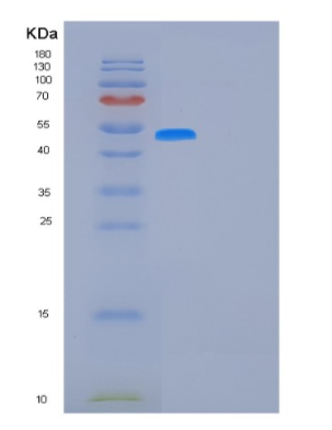 Recombinant Human FUCA1 Protein