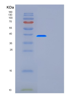 Recombinant Human FUT7 Protein
