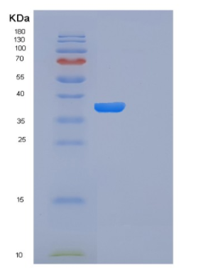 Recombinant Human FN3K Protein