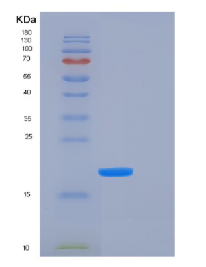 Recombinant Human FTL Protein