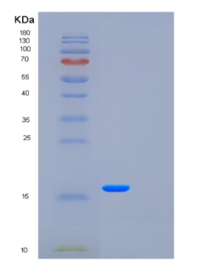 Recombinant Human FXYD5 Protein