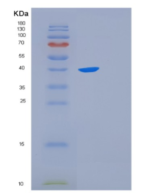 Recombinant Human FKBPL Protein