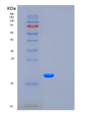 Recombinant Colony Stimulating Factor 3, Granulocyte (GCSF)