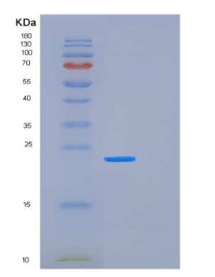 Recombinant Human FTSJ2 Protein