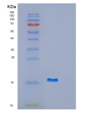 Recombinant Human GABARAPL1 Protein