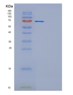 Recombinant Human GAD1-iso1 Protein