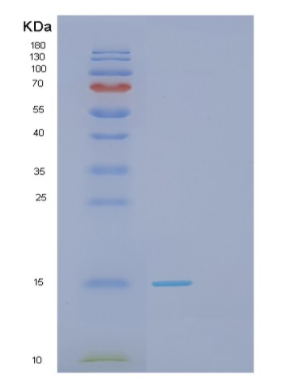 Recombinant Human GAGE2D Protein