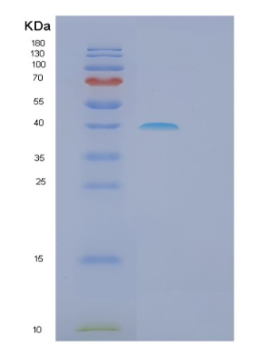 Recombinant Human GALE Protein