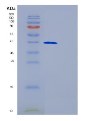 Recombinant Human GALM Protein