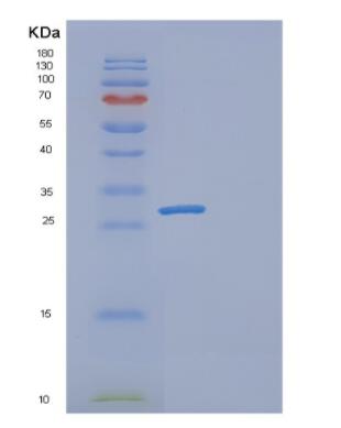 Recombinant Human GAMT Protein