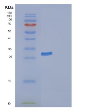 Recombinant Human GAP43 Protein