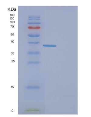 Recombinant Mouse GAPDH Proteina