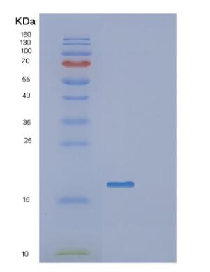 Recombinant Human GATC Protein