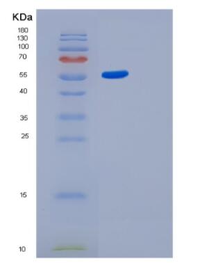 Recombinant Human GBA3 Protein