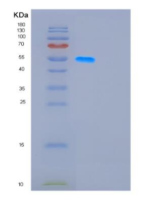 Recombinant Human GDA Protein