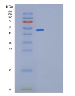 Recombinant Human GDI1 Protein