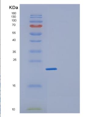 Recombinant Human GEMIN6 Protein