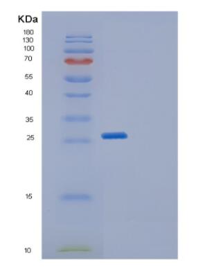 Recombinant Human GFER Protein