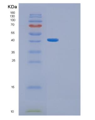 Recombinant Human GFPT1 Protein