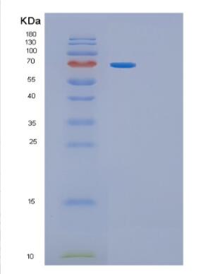 Recombinant Rat Gfra1 Protein