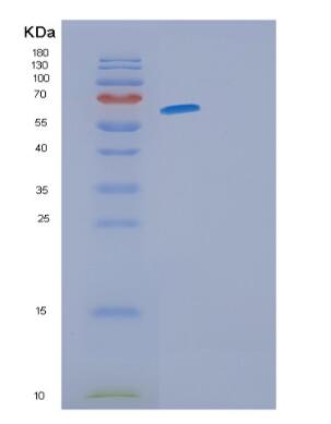 Recombinant Human GFRA3 Protein