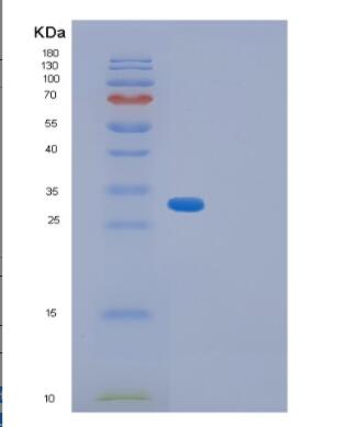 Recombinant Human GID8 Protein