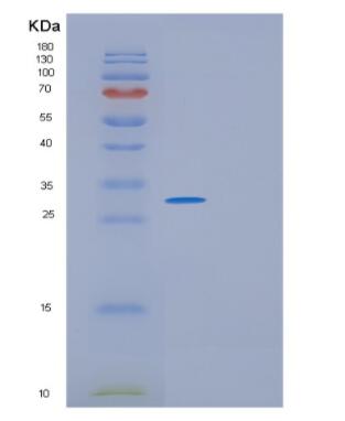 Recombinant Human GINS4 Protein