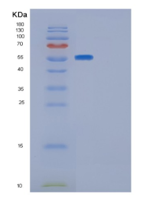 Recombinant Human GLUD1 Protein