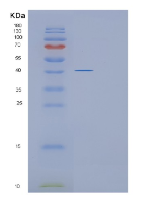 Recombinant Human GLUL Protein