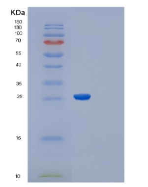 Recombinant Schistosoma japonicum RecombinantGlutathione S-Transferase(GST) Protein