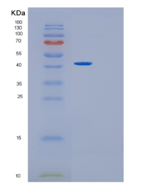 Recombinant Human GMDS Protein