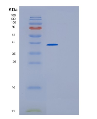 Recombinant Human GMPR Protein