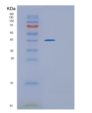 Recombinant Human GMPR2 Protein