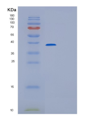 Recombinant Human Glutaredoxin-3 Protein