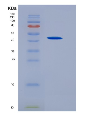 Recombinant Colony Stimulating Factor 2, Granulocyte Macrophage (GM-CSF)