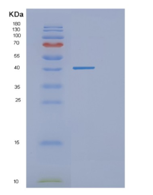 Recombinant Human GNB3 Protein
