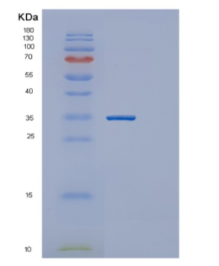 Recombinant Human GNMT Protein