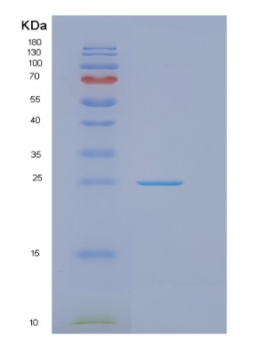 Recombinant Human GOSR2 Protein