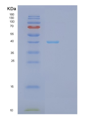 Recombinant Human GPD1L Protein