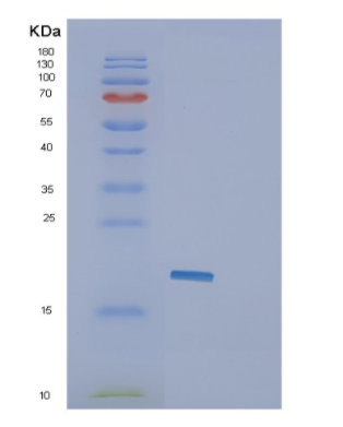 Recombinant Human GLIPR2 Protein