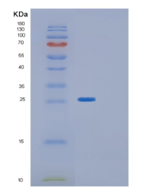 Recombinant Human GLTPD1 Protein