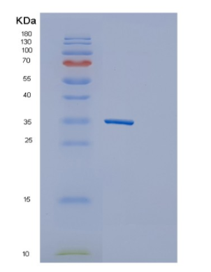 Recombinant Human GNPDA1 Protein