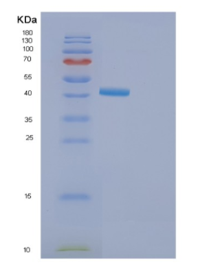 Recombinant Human GOLM1 Protein