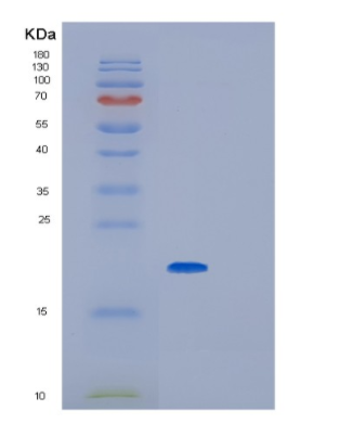 Recombinant Human Glyoxalase I Protein