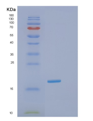 Recombinant Human GOLGA7 Protein