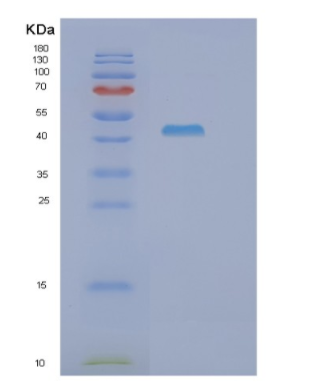 Recombinant Human GOT1 Protein