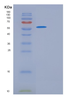 Recombinant Rat Gpt Protein