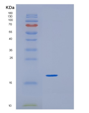 Recombinant Human GREM1 Protein