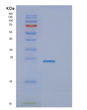 Recombinant Human GNPNAT1 Protein