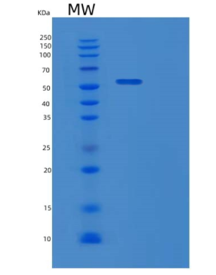 Recombinant Human GPNMB Protein